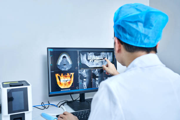 Best Emergency Treatment for Toothache in San Mateo, CA